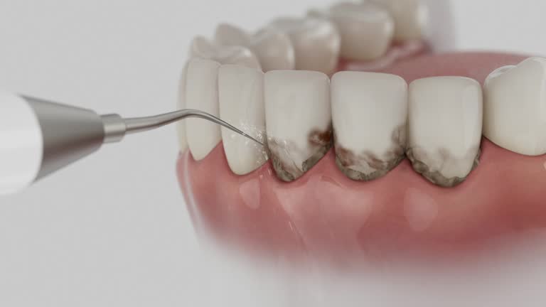 Trusted Teeth Cleaning And Checkup service in Dayton, KY - Dentist Open Now